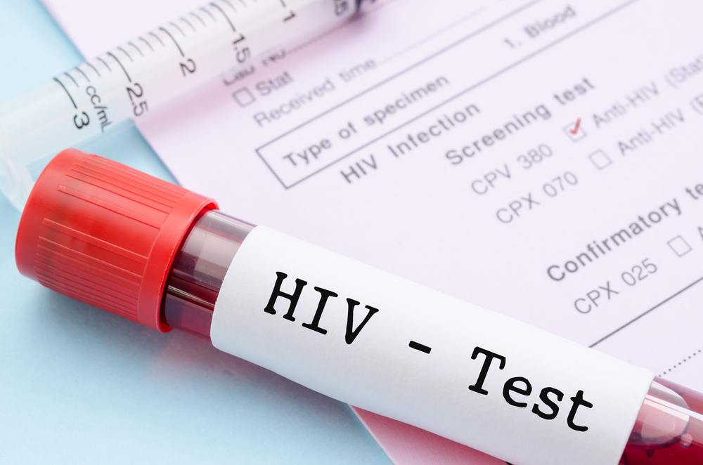 cum să transmiteți HIV