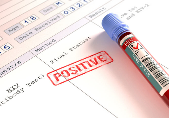 Recunoașteți simptomele precoce ale infecției cu HIV