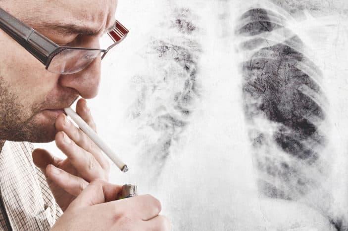 simptome ale cancerului pulmonar