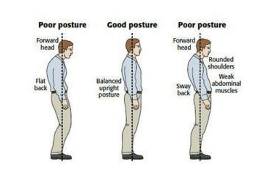 Sursa imaginii: http://www.thephysiocompany.com/blog/stop-slouching-postural-dysfunction-symptoms-causes-and-treatment-of-bad-posture