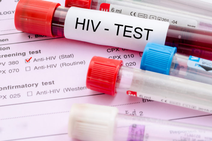 Testul HIV