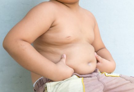 obezitate la copii