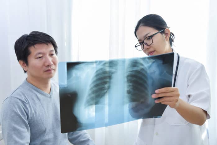 boala pulmonară interstițială
