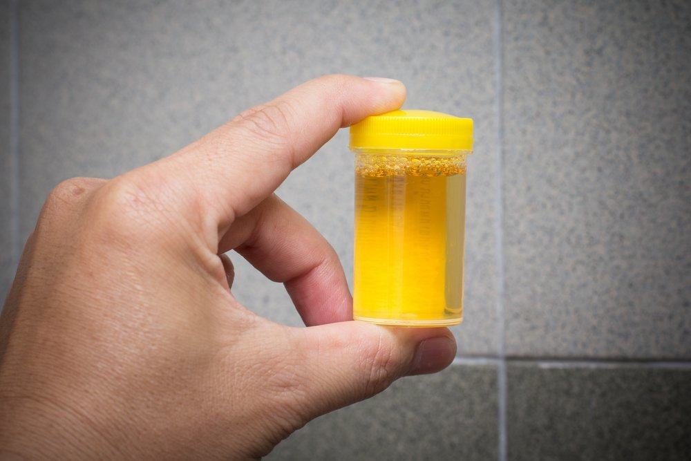 urină terapie pentru a bea urină
