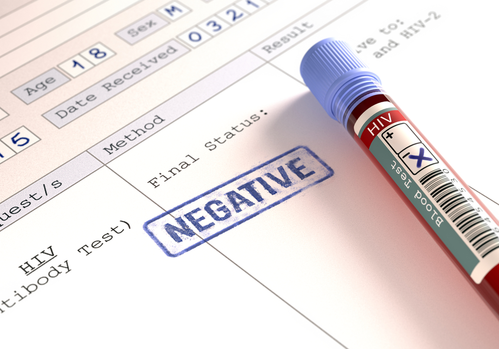 semnificația rezultatelor testului HIV negativ