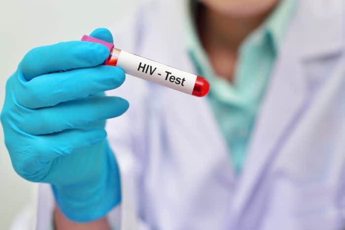 Testul de sânge HIV