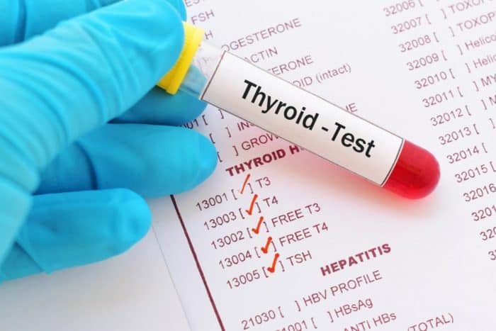 testarea funcției tiroidiene